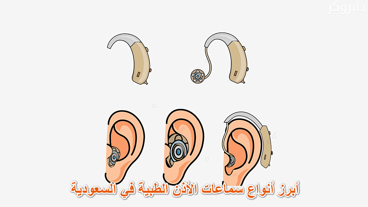 أبرز أنواع سماعات الأذن الطبية في السعودية