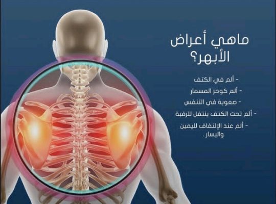 الحل النهائي الأمثل لآلام الابهر وأسفل الظهر
