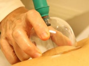 افضل حجام بالرياض|حجامه بالرياض|حجام ممتاز