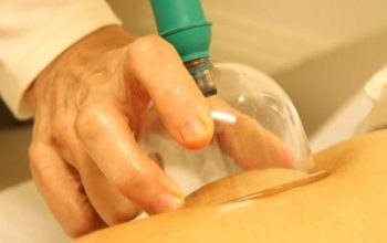 افضل حجام بالرياض|حجامه بالرياض|حجام ممتاز